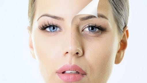 Top Tips to Get Rid of Under Eyes Dark Circles