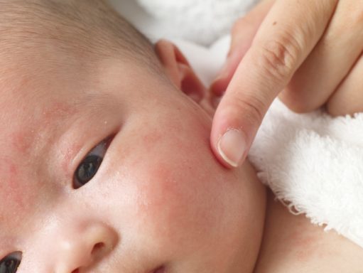 Top Common Skin Problems In Kids & Tips To Cure