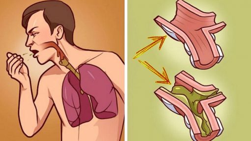 Top Ways To Relieve Chest Congestion