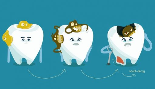 How to prevent dental decay