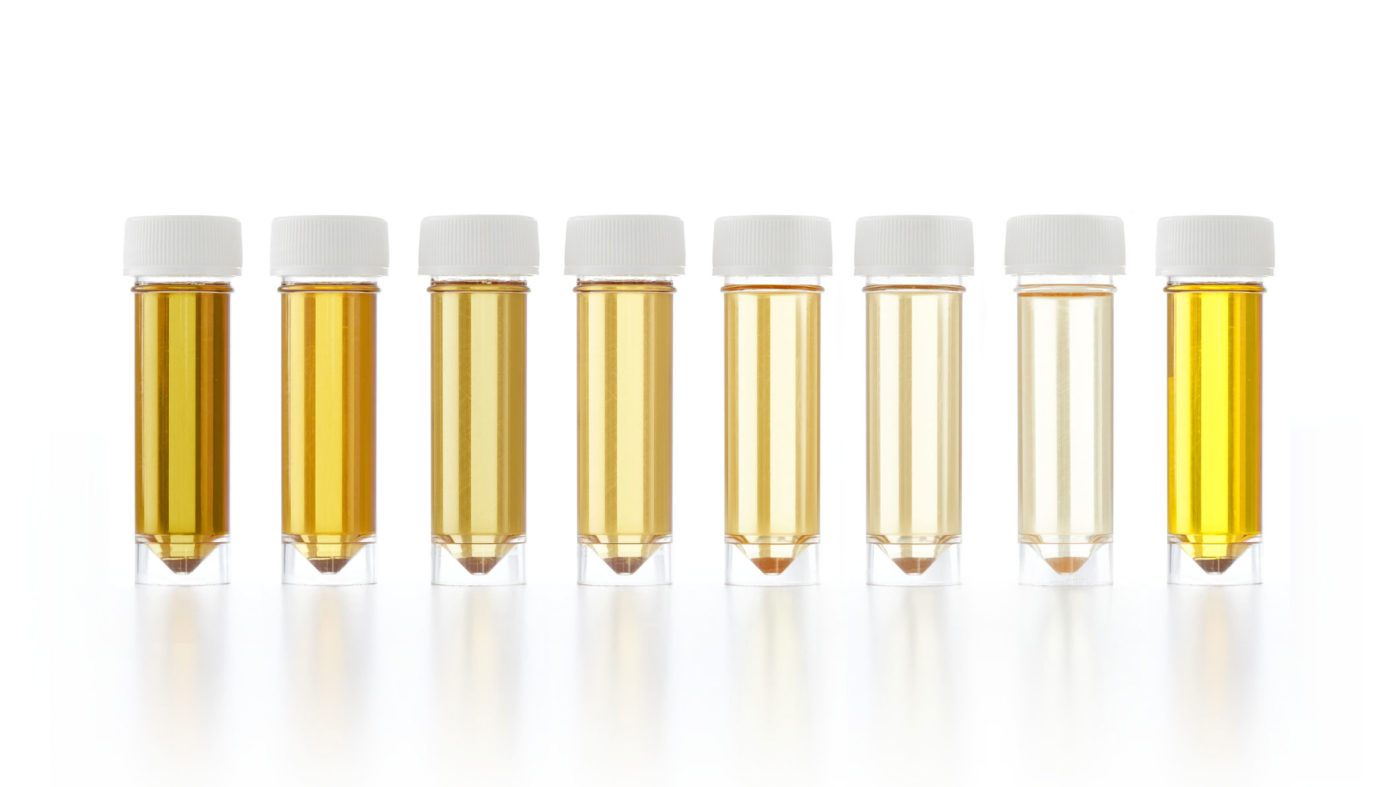 Your Urine Colour & Its Meaning in terms of current health!