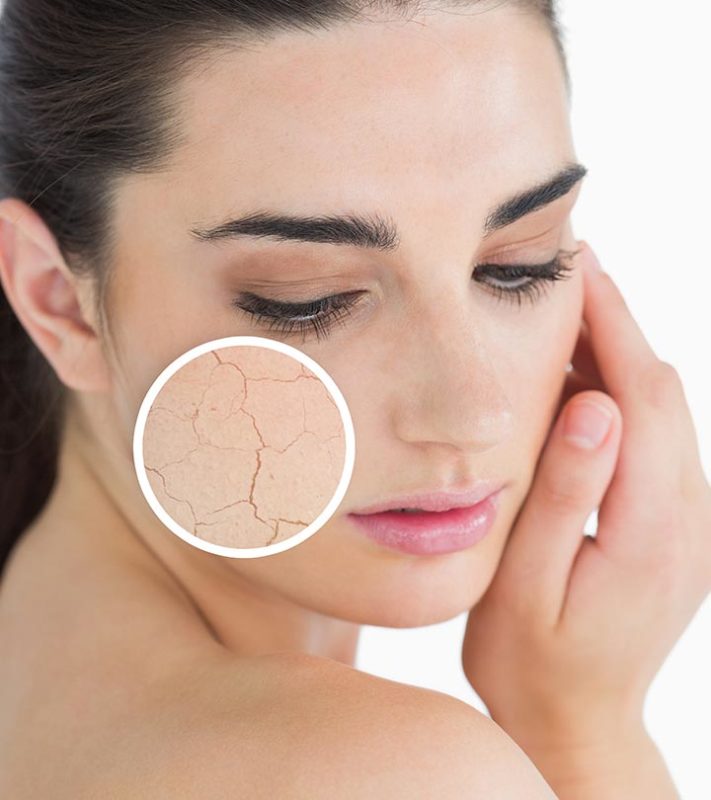 Top skin tips For Dry Skin In Winter