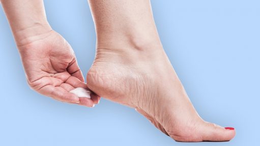 Try These Effective Remedies To Heal Cracked Heels