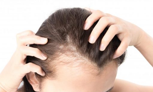 Top 5 Grooming Mistakes To Avoid Hair Thinning