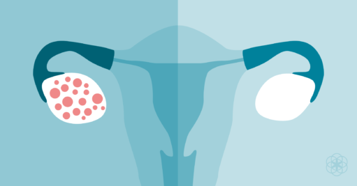 Top Healthy Eating Habits For Women With PCOS