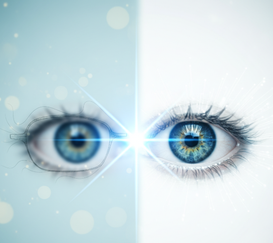 Considering Laser Vision Correction? Here’s What You Need to Know