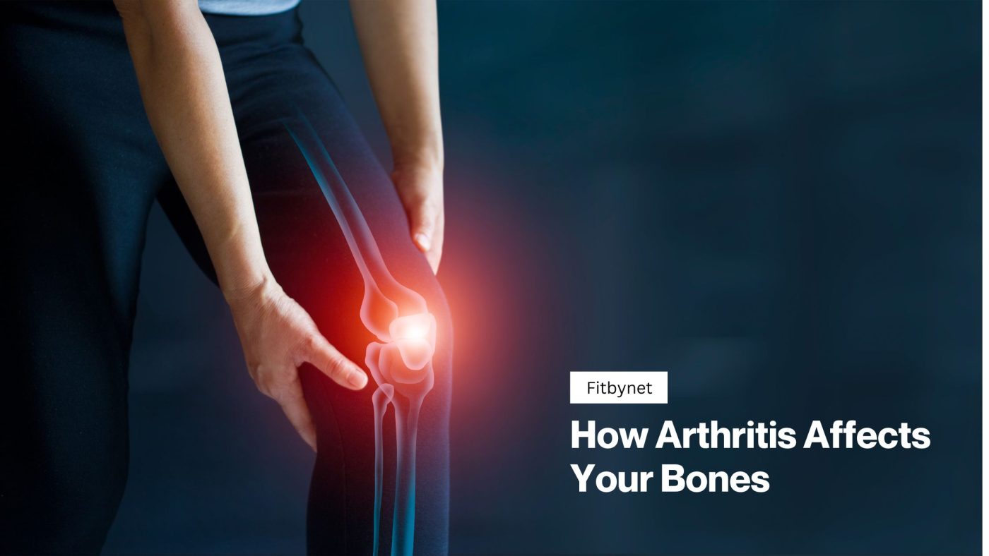 How Arthritis Affects Your Bones