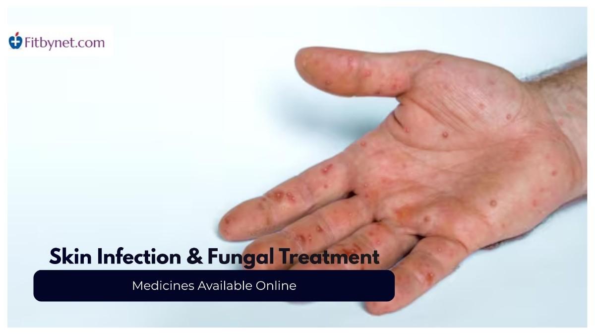 Skin-Infection-&-Fungal-Treatment
